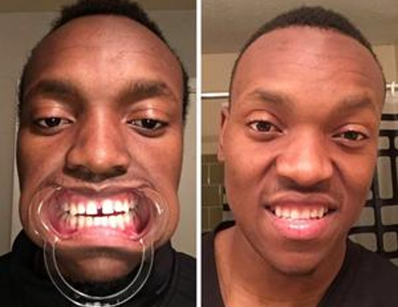 Before_After__Shingriai_300x.jpg